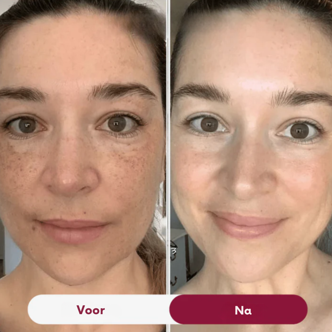 NanoGlow – Huidherstellend Collageenmasker