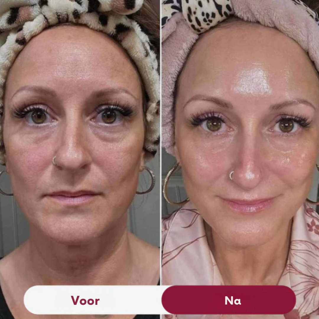 NanoGlow – Huidherstellend Collageenmasker