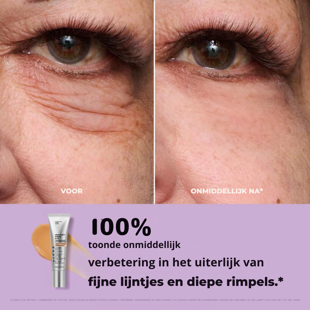 Viceé - FirmX Lift in a Blink
