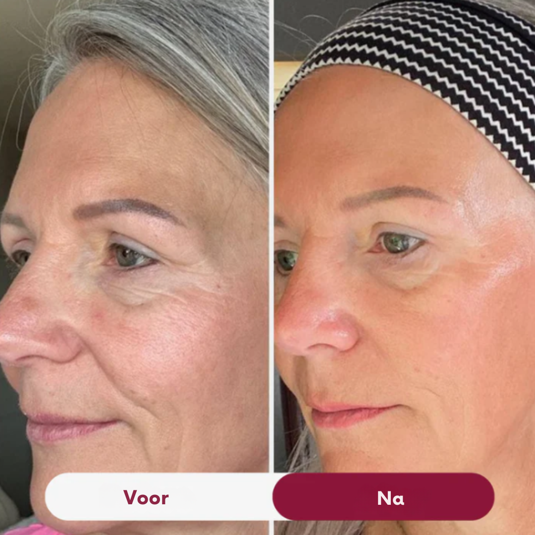 NanoGlow – Huidherstellend Collageenmasker