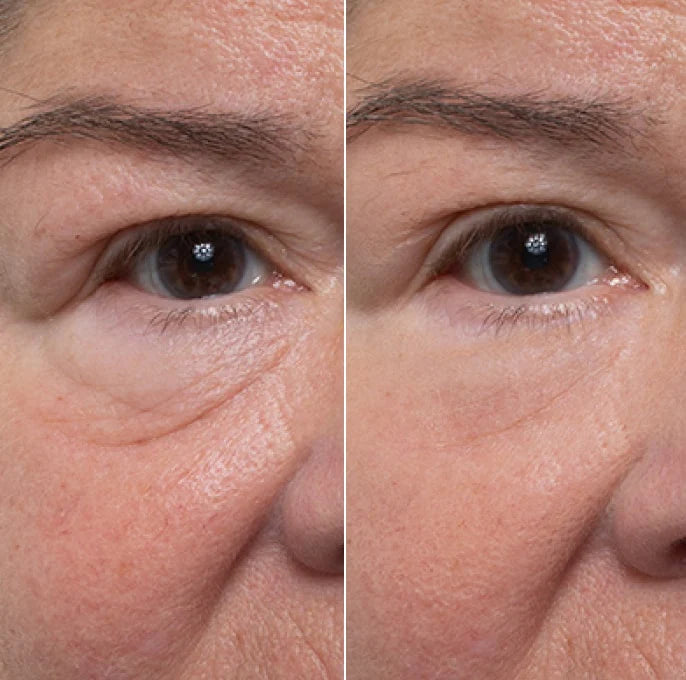 NUUDAY - 60 Sec Eye Firming Gel