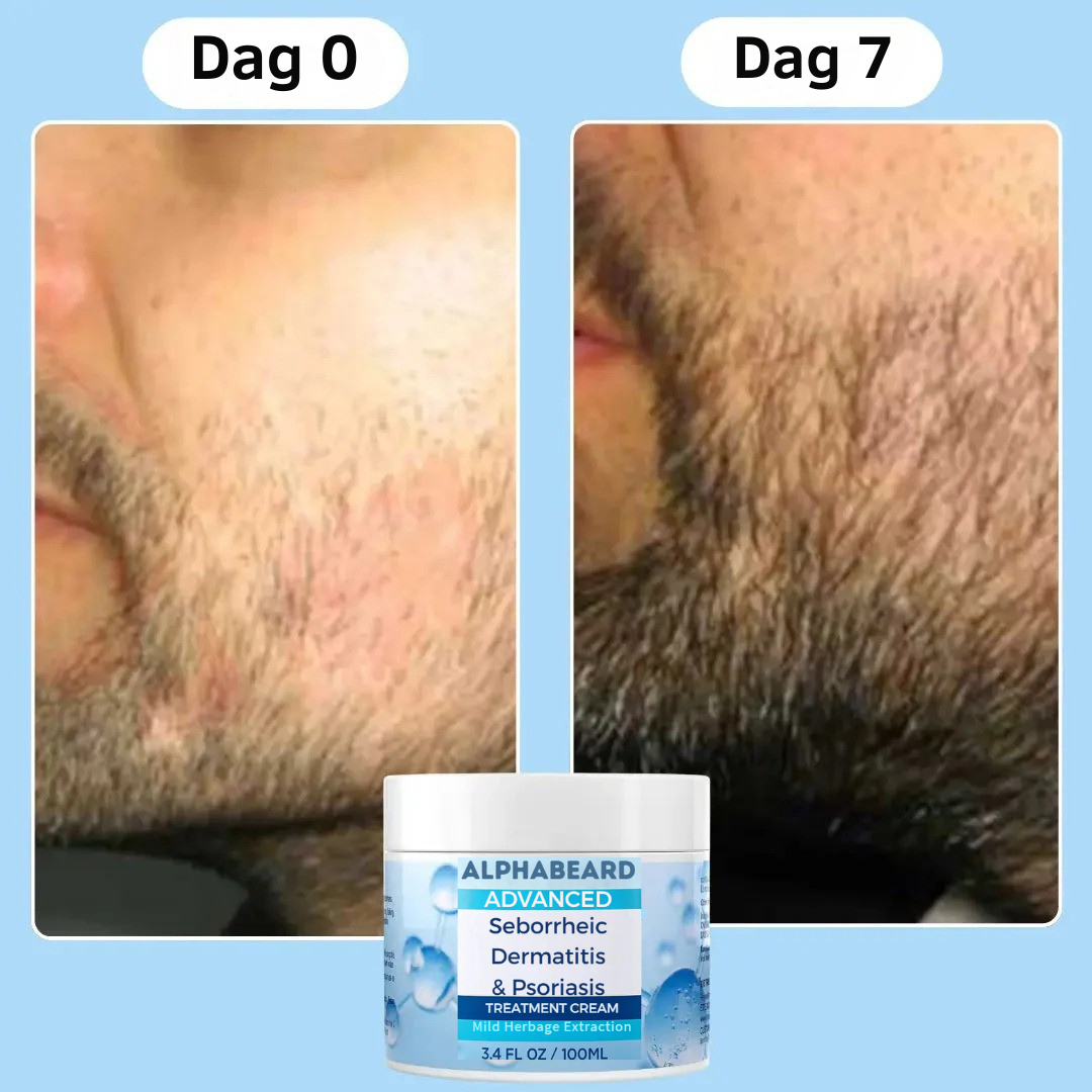AlphaBeard – Zachtere Baard Binnen 30 Seconden