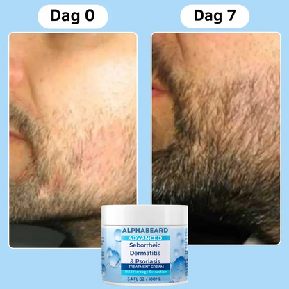 AlphaBeard – Zachtere Baard Binnen 30 Seconden