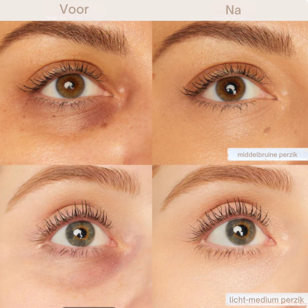 Zivelle Oogcontour Perfector