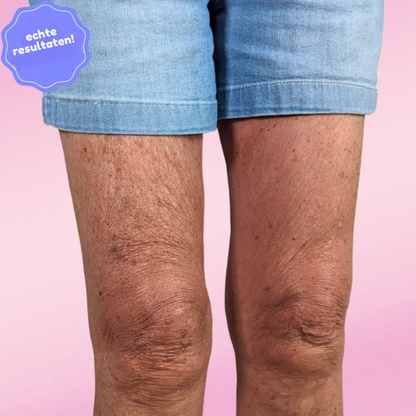 Lifttera – Cellulitis Tape