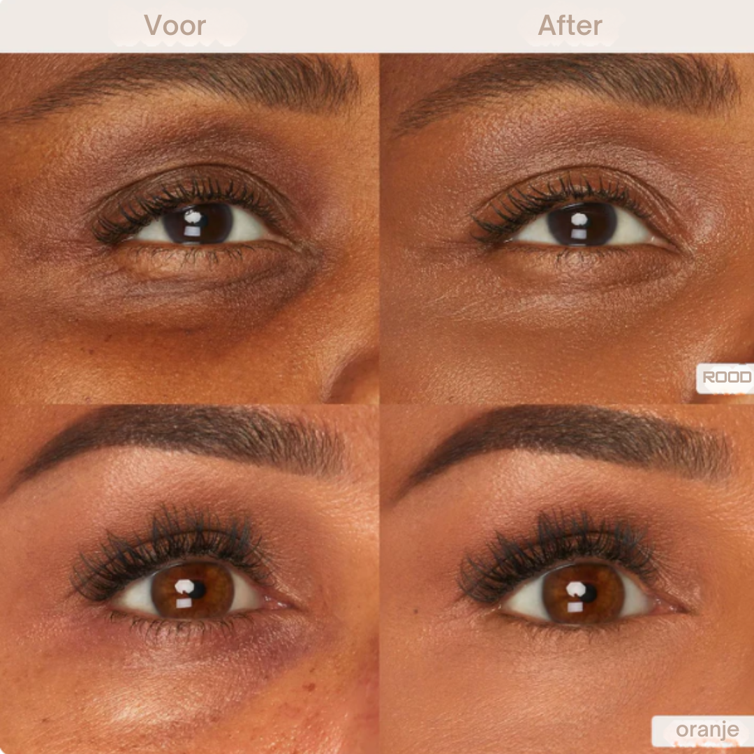 Zivelle Oogcontour Perfector