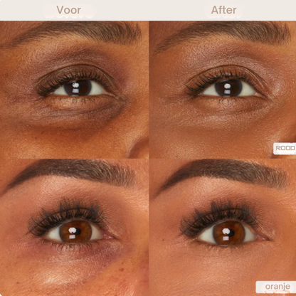 Zivelle Oogcontour Perfector