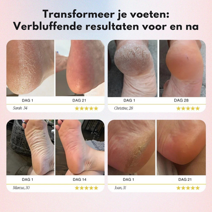 BareStap – Elektrische Eeltverwijderaa