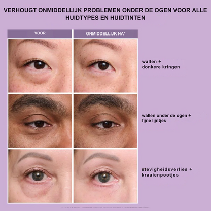 Viceé -  FirmX Lift in a Blink