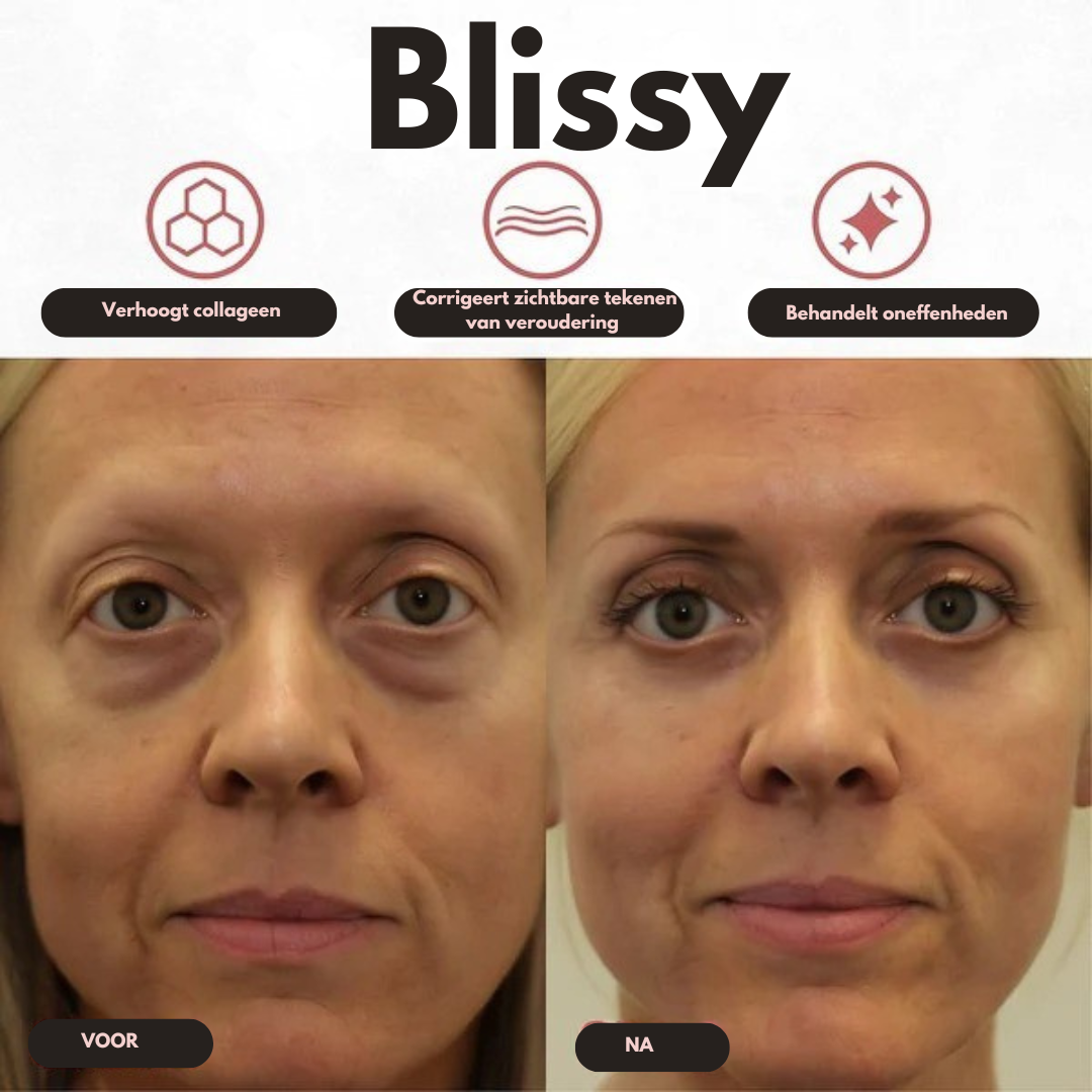 Blissy – Herstel wat stress je heeft ontnomen. Herwin je uitstraling.