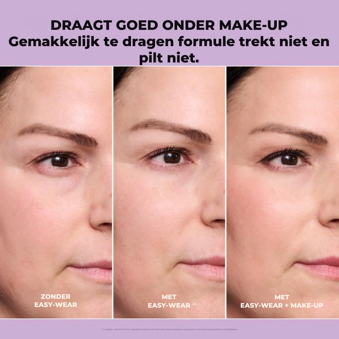 Viceé -  FirmX Lift in a Blink