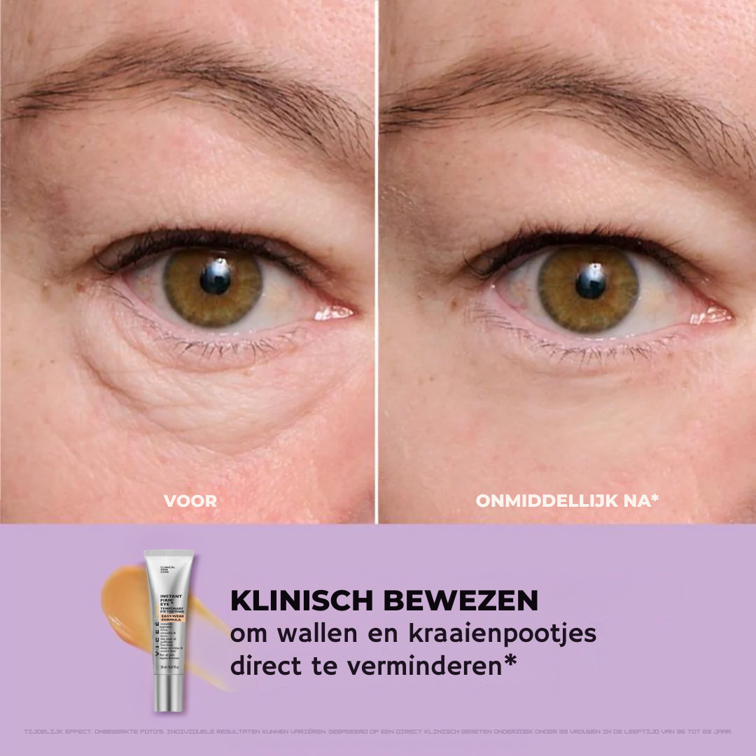 Viceé -  FirmX Lift in a Blink