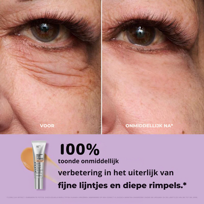 Viceé -  FirmX Lift in a Blink