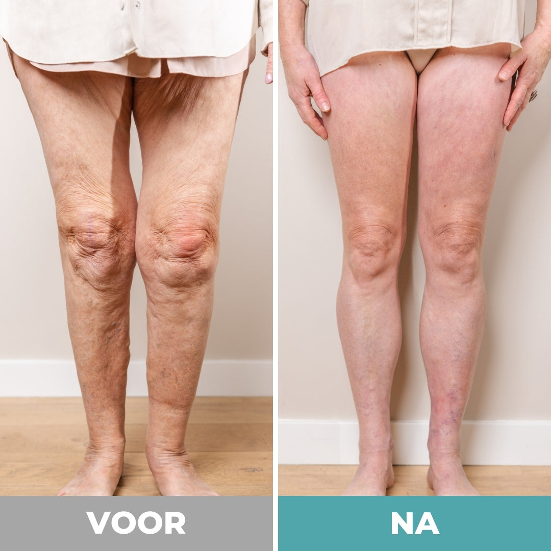 EAZEN™ Voetmassager