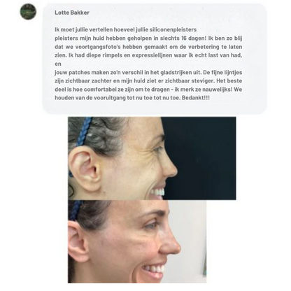 Barebliss – Medische siliconenplaten voor littekenverlichting