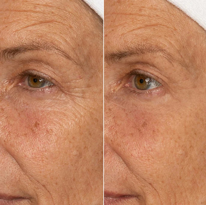 NUUDAY - 60 Sec Eye Firming Gel