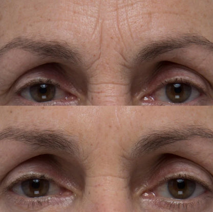 NUUDAY - 60 Sec Eye Firming Gel